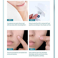 Пластири за акне PYUNKANG Yul ACNE Spot Patch Super Thin 15бр