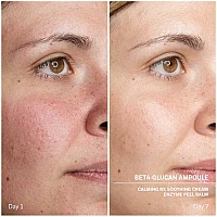 Мощен успокояващ серум Babor Power Serum Beta Glucan Ampoule 7x2ml